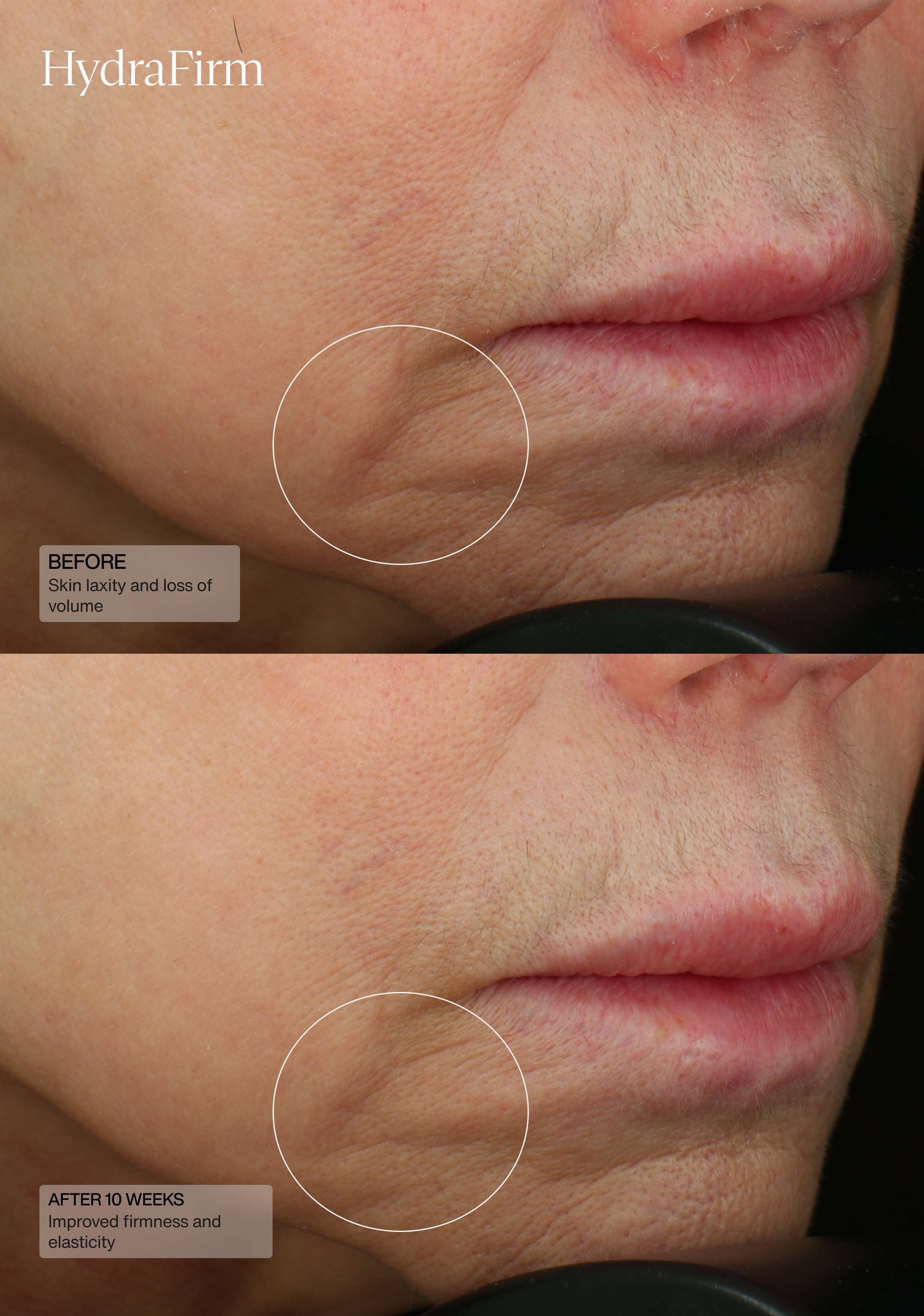 HydraFirm (Dermal Contour Pressed Serum)