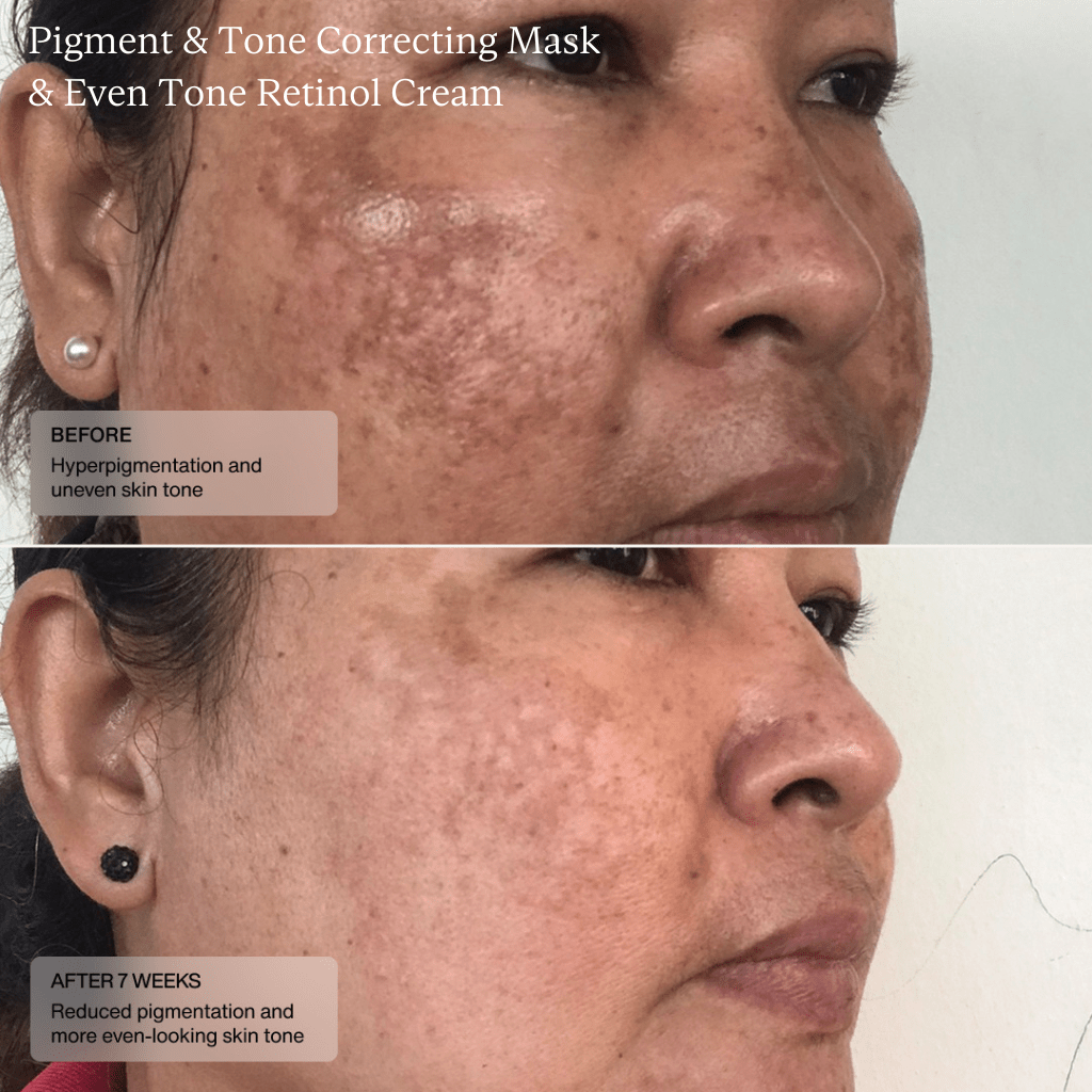 Pigment & Tone Correcting Mask