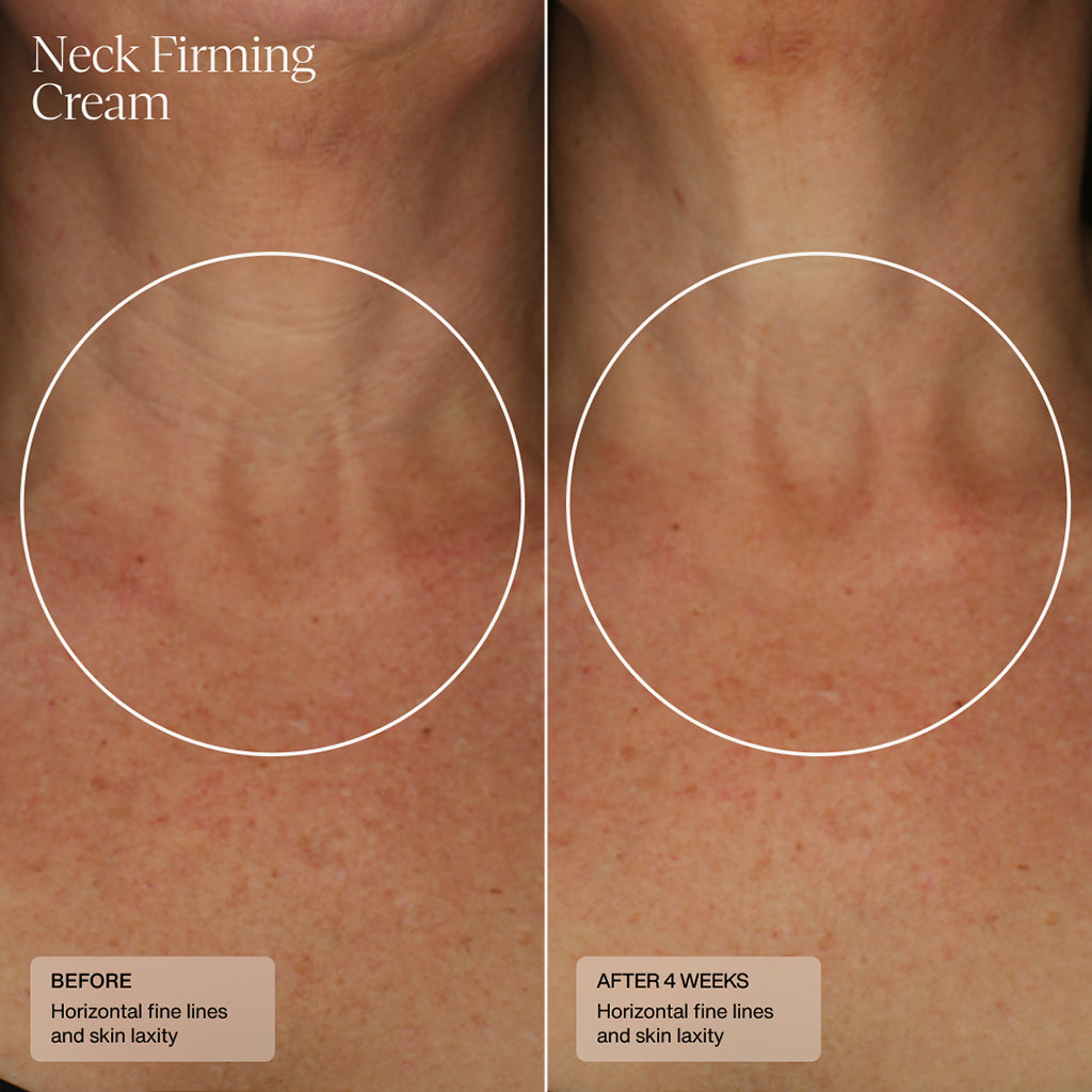 Neck Firming Cream